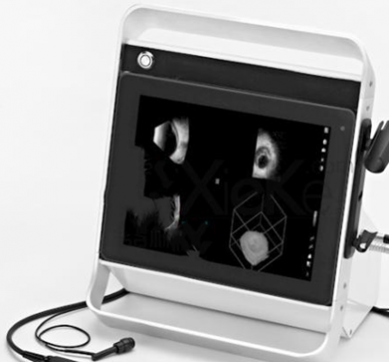 眼科超声诊断仪  cas-2000ber