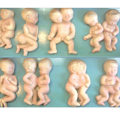 胎儿畸形模型 YJ/ZZ2015