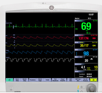 病人监护仪 CARESCAPE Monitor B450