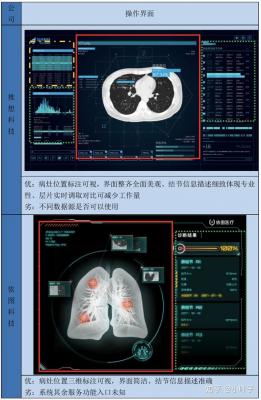 肺结节CT影像辅助检测软件Yitu_AICare_CT_Chest