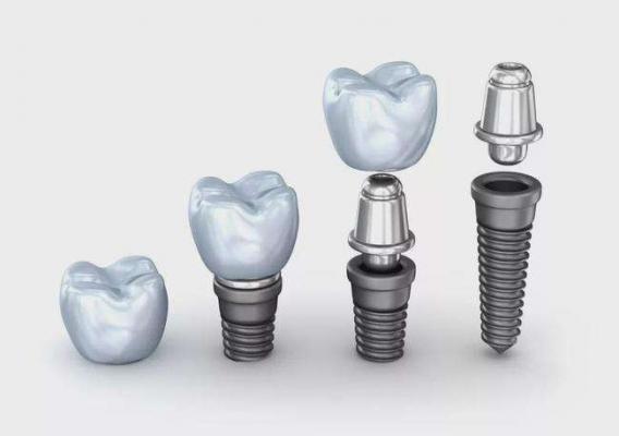 牙科种植系统Dental Implant System