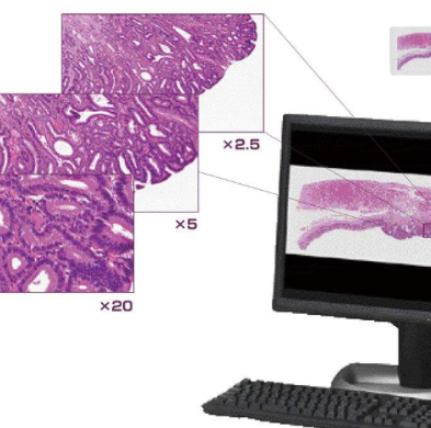 kf-tct-400宫颈细胞扫描分析系统
