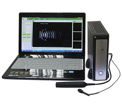 carescan-1全数字超声显像诊断仪