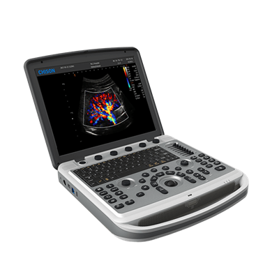 sonobook 5便携式彩色超声诊断系统