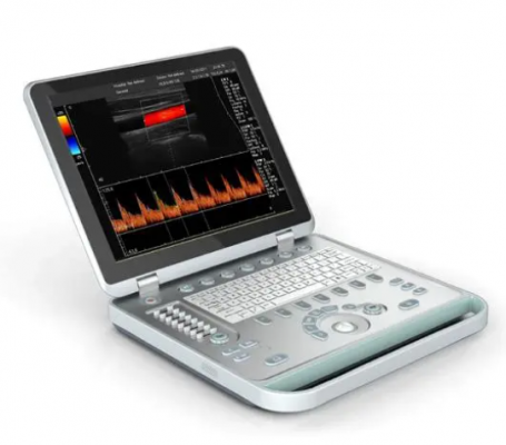 微型彩色超声诊断系统c30l