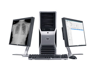 医学影像工作站系统软件 seeker-400