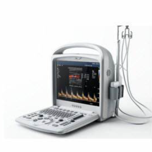 s10掌式无线彩色多普勒超声诊断系统