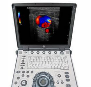 彩色超声诊断系统navi i6