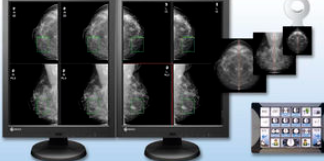 mammoworks乳腺医学图像处理软件