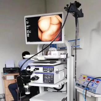 tr-escgv-02胃肠镜视野清晰度增强仪