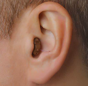 耳道式助听器e-cic系列