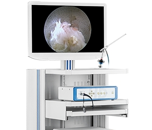 冠龙医用内窥镜摄像系统ys-i