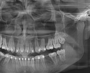 美亚光电mydentviewer口腔医学影像处理软件