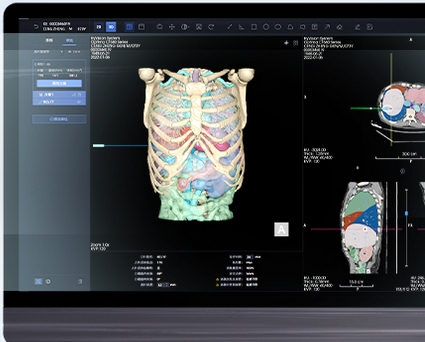 海杰亚hyvision-liverctlite肝脏ct影像处理软件