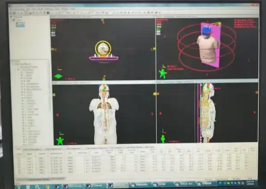 放射治疗信息管理系统xhrtims新华