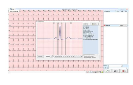 心电信息管理软件ecgnet01华清心仪