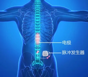  体外脊髓神经刺激测试系统