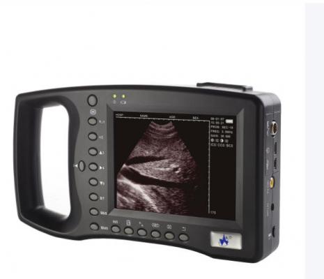 sd-dbp201 全数字掌上超声诊断仪 厂家